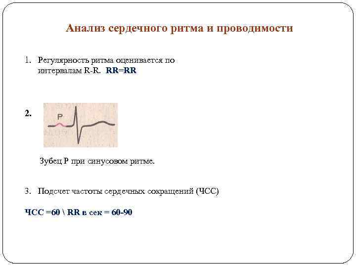 Анализ сердечного ритма и проводимости 1. Регулярность ритма оценивается по интервалам R-R. RR=RR 2.