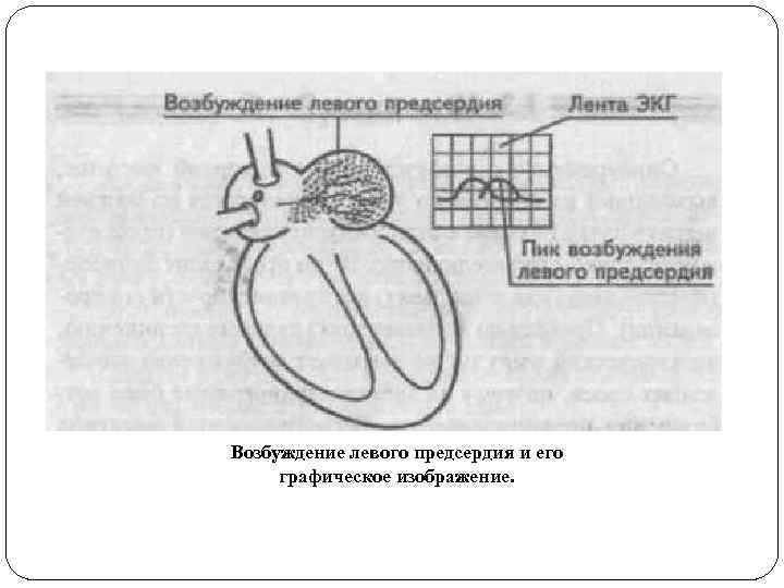 Возбуждение левого предсердия и его графическое изображение. 