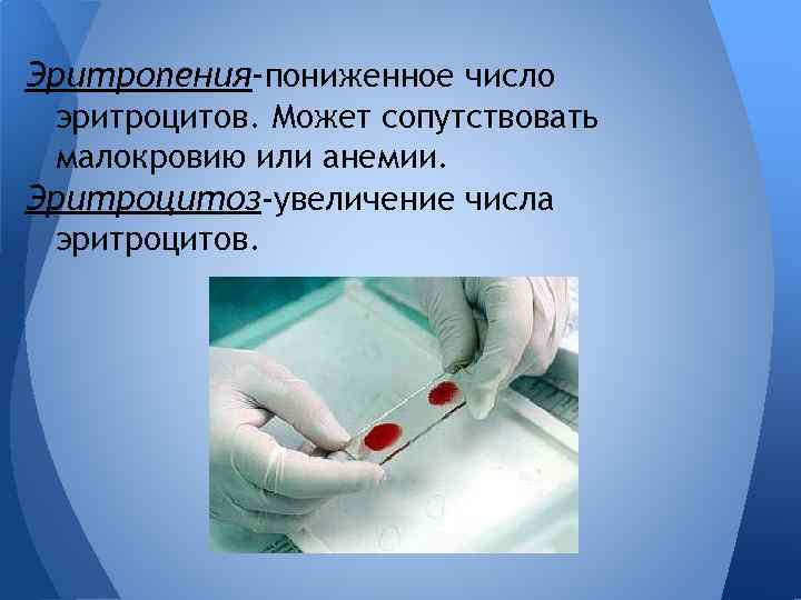 Эритропения-пониженное число эритроцитов. Может сопутствовать малокровию или анемии. Эритроцитоз-увеличение числа эритроцитов. 