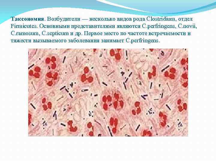 Таксономия. Возбудители — несколько видов рода Clostridium, отдел Firmicutes. Основными представителями являются C. perfringens,