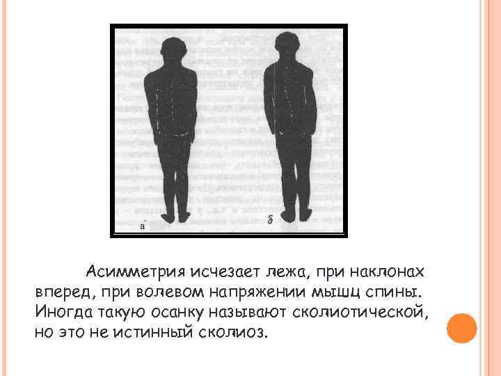 Асимметрия исчезает лежа, при наклонах вперед, при волевом напряжении мышц спины. Иногда такую осанку