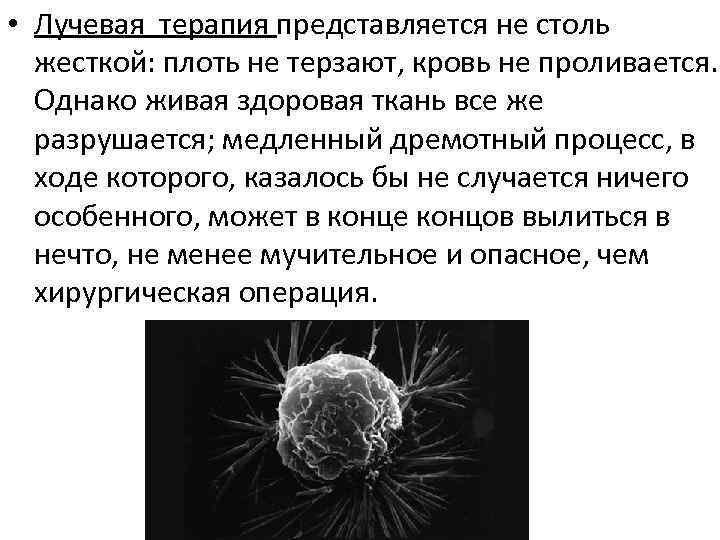  • Лучевая терапия представляется не столь жесткой: плоть не терзают, кровь не проливается.