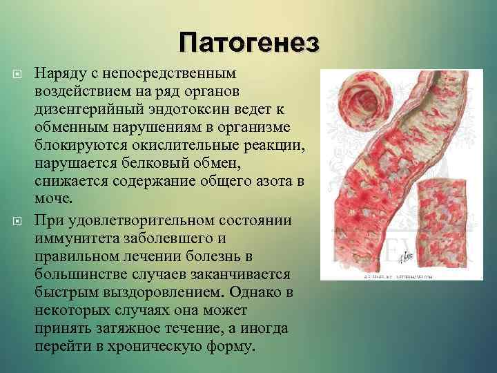 Патогенез Наряду с непосредственным воздействием на ряд органов дизентерийный эндотоксин ведет к обменным нарушениям