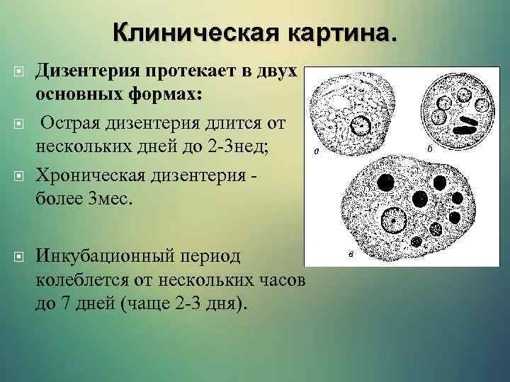 Клиническая картина. Дизентерия протекает в двух основных формах: Острая дизентерия длится от нескольких дней