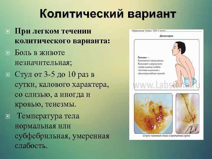 Колитический вариант При легком течении колитического варианта: Боль в животе незначительная; Стул от 3