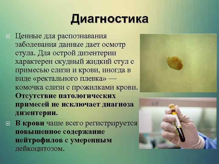 Диагностика Ценные для распознавания заболевания данные дает осмотр стула. Для острой дизентерии характерен скудный