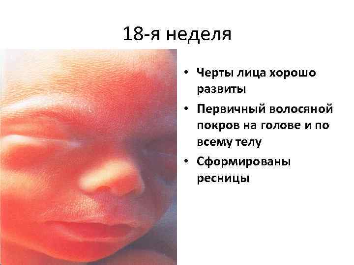 18 -я неделя • Черты лица хорошо развиты • Первичный волосяной покров на голове