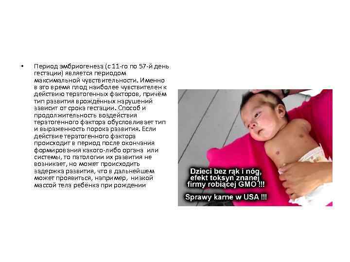  • Период эмбриогенеза (с 11 -го по 57 -й день гестации) является периодом