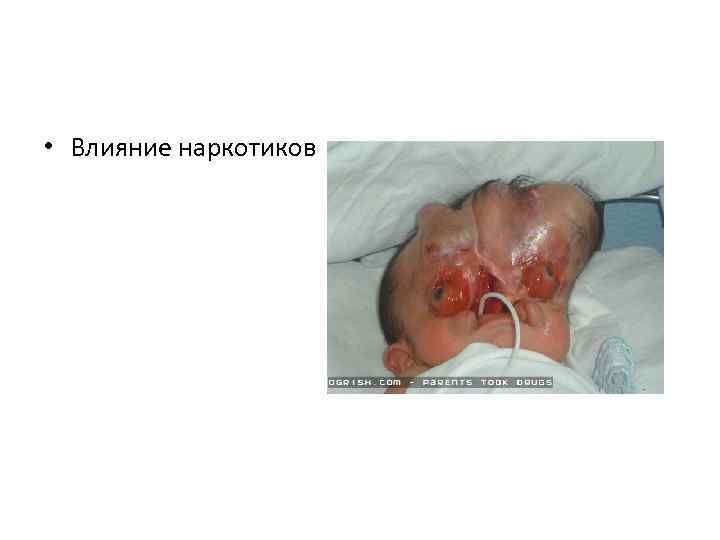  • Влияние наркотиков 