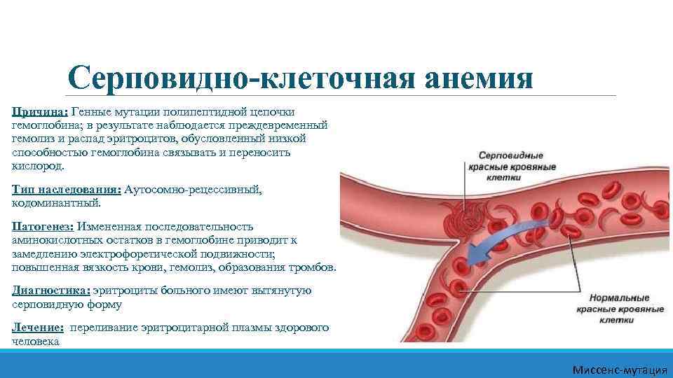 Серповидно-клеточная анемия Причина: Генные мутации полипептидной цепочки гемоглобина; в результате наблюдается преждевременный гемолиз и