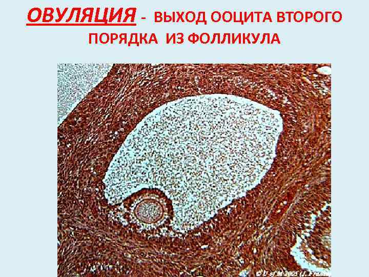 ОВУЛЯЦИЯ - ВЫХОД ООЦИТА ВТОРОГО ПОРЯДКА ИЗ ФОЛЛИКУЛА 