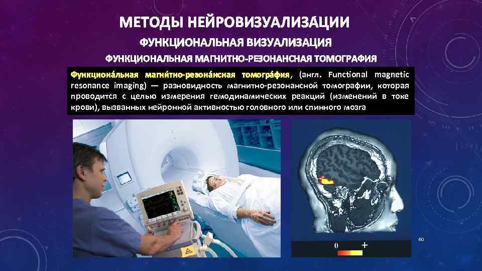 МЕТОДЫ НЕЙРОВИЗУАЛИЗА ЦИИ ФУНКЦИОНАЛЬНАЯ ВИЗУАЛИЗАЦИЯ ФУНКЦИОНАЛЬНАЯ МАГНИТНО-РЕЗОНАНСНАЯ ТОМОГРАФИЯ Функциона льная магни тно-резона нсная томогра