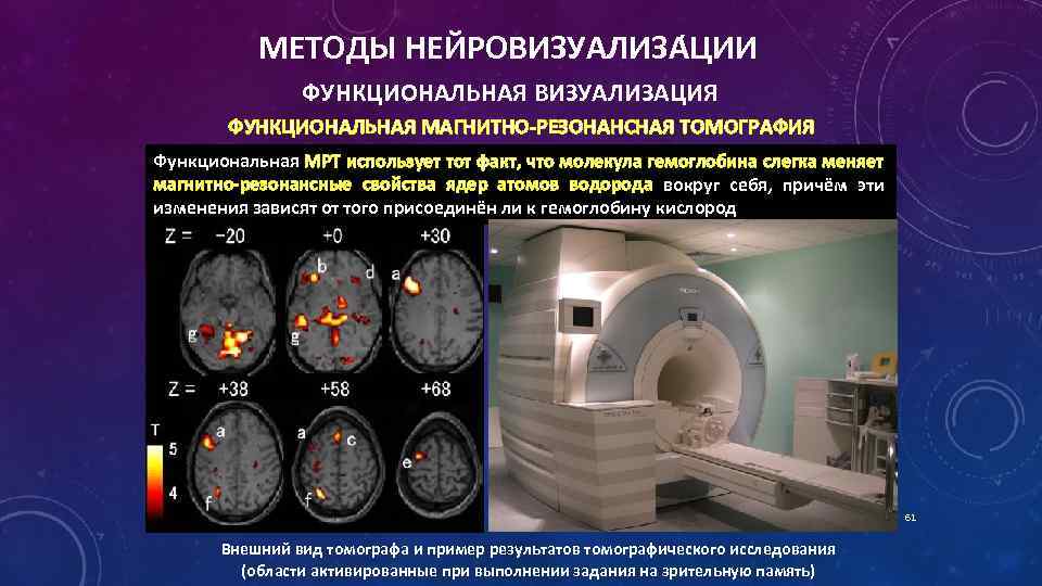 Медики создали на компьютере схему мозга пациента как своеобразную навигационную карту