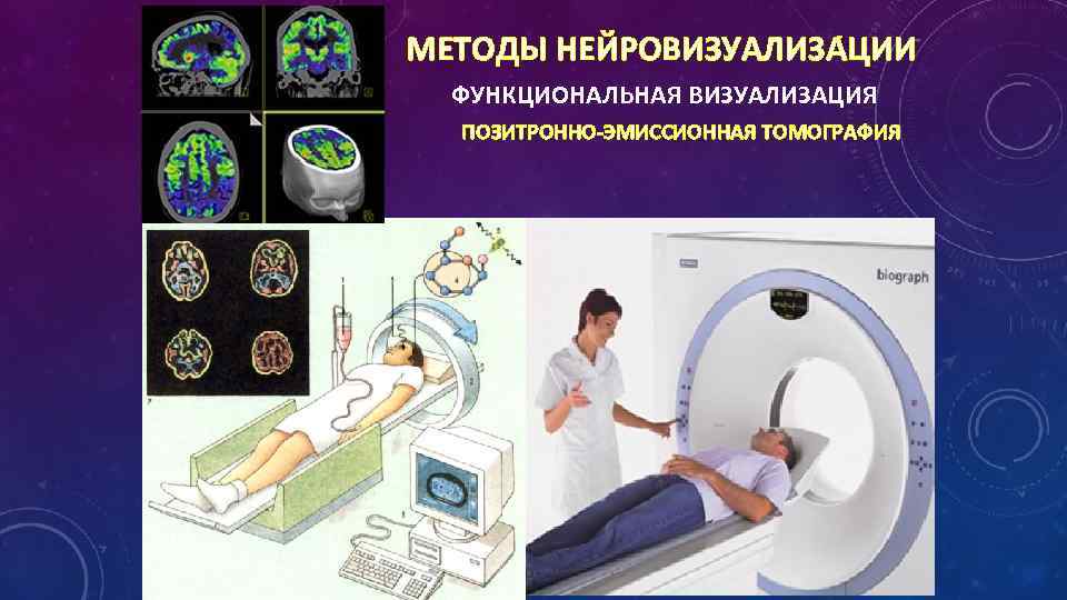 МЕТОДЫ НЕЙРОВИЗУАЛИЗА ЦИИ ФУНКЦИОНАЛЬНАЯ ВИЗУАЛИЗАЦИЯ ПОЗИТРОННО-ЭМИССИОННАЯ ТОМОГРАФИЯ 