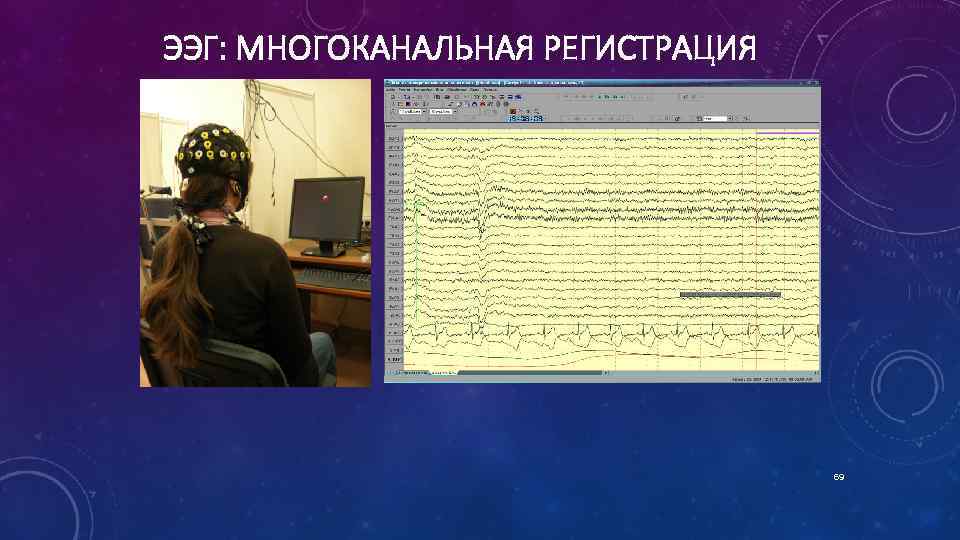 ЭЭГ: МНОГОКАНАЛЬНАЯ РЕГИСТРАЦИЯ 69 