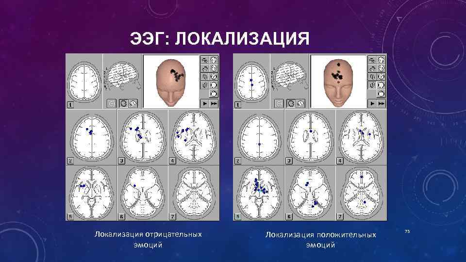 ЭЭГ: ЛОКАЛИЗАЦИЯ Локализация отрицательных эмоций Локализация положительных эмоций 73 