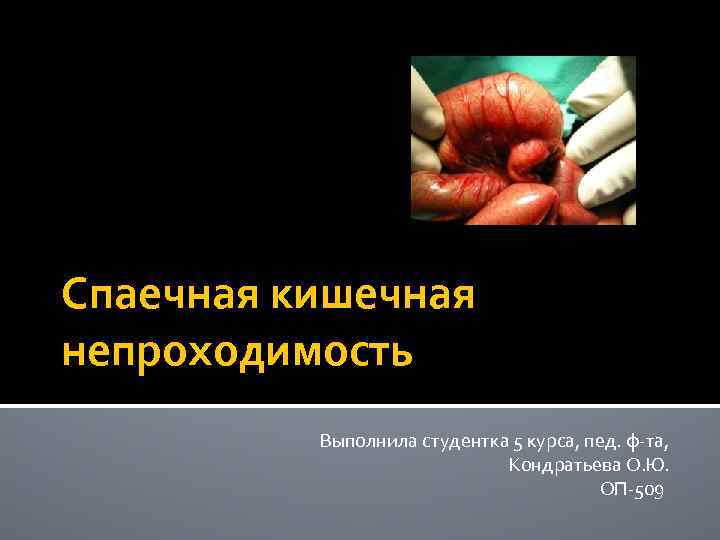 Спаечная кишечная непроходимость Выполнила студентка 5 курса, пед. ф-та, Кондратьева О. Ю. ОП-509 