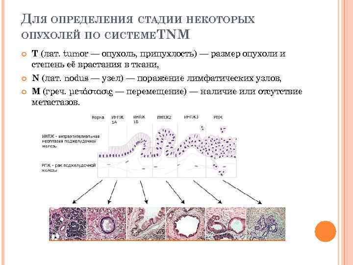 ДЛЯ ОПРЕДЕЛЕНИЯ СТАДИИ НЕКОТОРЫХ ОПУХОЛЕЙ ПО СИСТЕМЕ TNM T (лат. tumor — опухоль, припухлость)