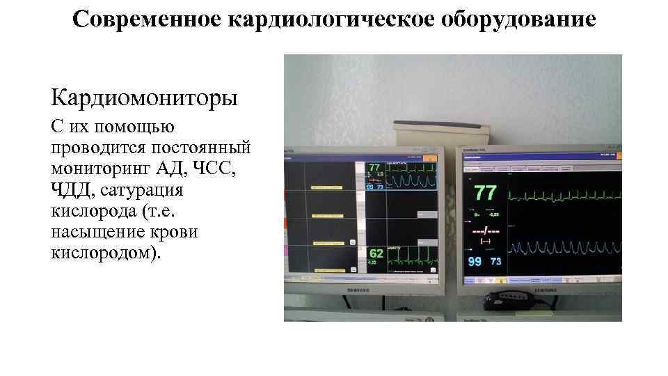 Сатурация на ивл. Кардиомониторы. Кардиологическое оборудование. Кардиомонитор ЧДД. Сатурация на мониторе.