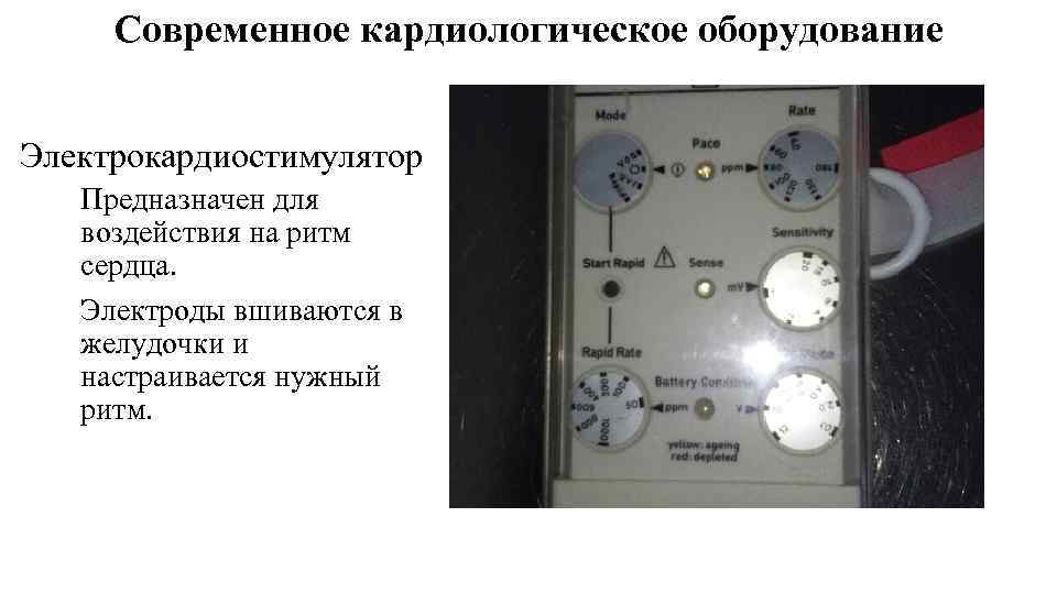 Современное кардиологическое оборудование Электрокардиостимулятор Предназначен для воздействия на ритм сердца. Электроды вшиваются в желудочки