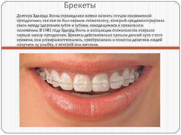 Брекеты Доктора Эдварда Энгля справедливо можно назвать «отцом современной ортодонтии» , так как он