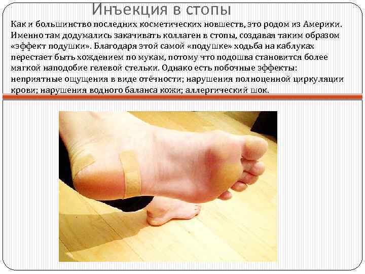 Инъекция в стопы Как и большинство последних косметических новшеств, это родом из Америки. Именно