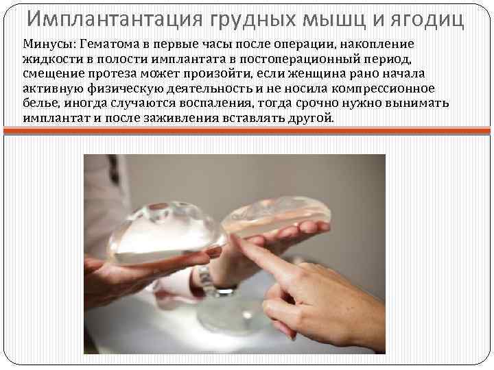 Имплантантация грудных мышц и ягодиц Минусы: Гематома в первые часы после операции, накопление жидкости