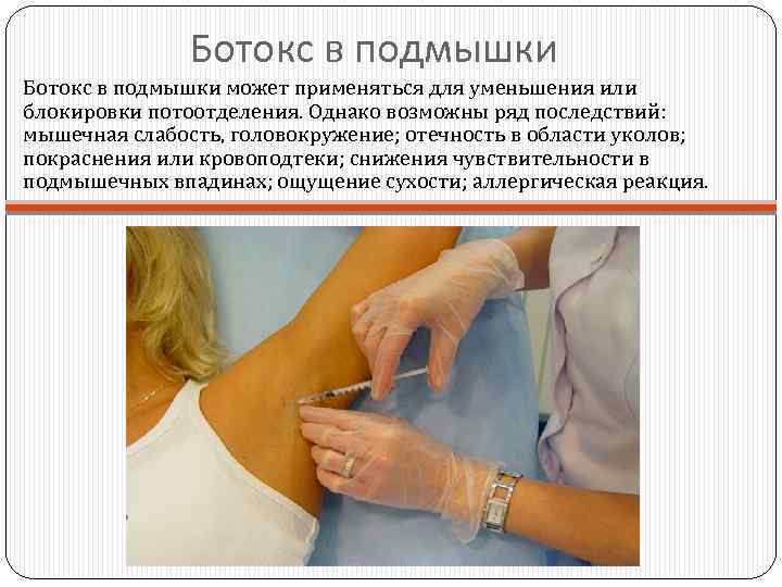 Ботокс в подмышки может применяться для уменьшения или блокировки потоотделения. Однако возможны ряд последствий: