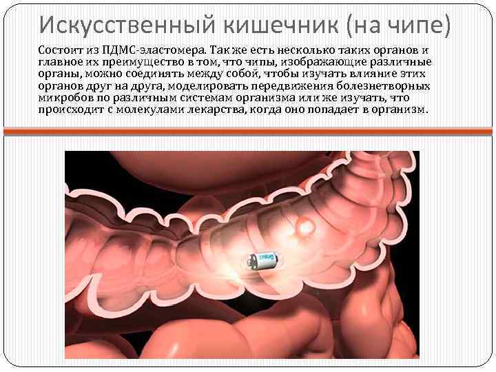 Искусственный кишечник (на чипе) Состоит из ПДМС-эластомера. Так же есть несколько таких органов и