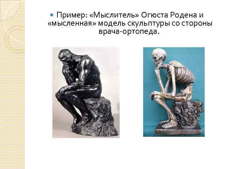 Пример: «Мыслитель» Огюста Родена и «мысленная» модель скульптуры со стороны врача-ортопеда. 