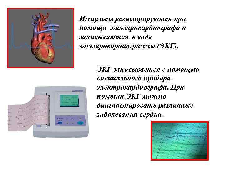 Импульсы регистрируются при помощи электрокардиографа и записываются в виде электрокардиограммы (ЭКГ). ЭКГ записывается с