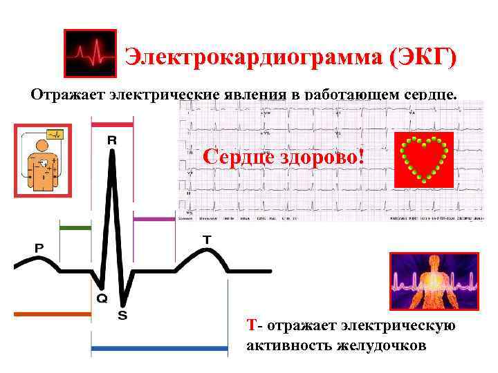 Электрокардиограмма (ЭКГ) Отражает электрические явления в работающем сердце. P- отражает электрическую Сердце здорово! активность