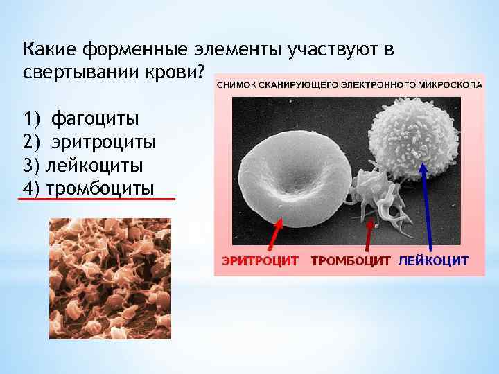 Какие клетки участвуют. Форменные элементы, участвующие в свертывании крови. Элементы участвующие в свертывании крови. Элементы крови участвуют в свертывании крови. Элементы крови участвующие в свертывании крови это.