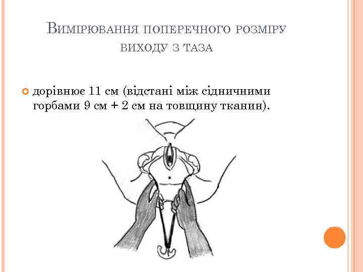 ВИМІРЮВАННЯ ПОПЕРЕЧНОГО РОЗМІРУ ВИХОДУ З ТАЗА дорівнює 11 см (відстані між сідничними горбами 9