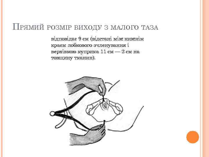 ПРЯМИЙ РОЗМІР ВИХОДУ З МАЛОГО ТАЗА відповідає 9 см (відстані між нижнім краєм лобкового