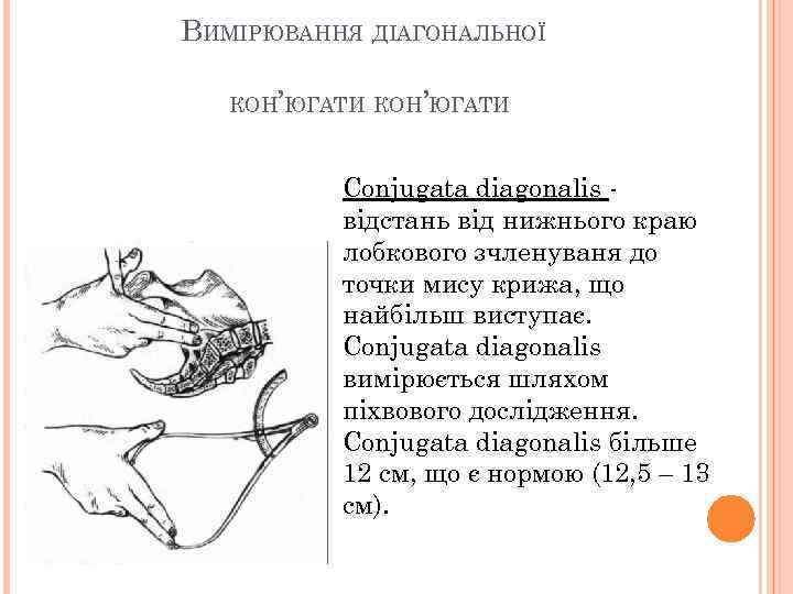 ВИМІРЮВАННЯ ДІАГОНАЛЬНОЇ КОН’ЮГАТИ Conjugata diagonalis відстань від нижнього краю лобкового зчленуваня до точки мису