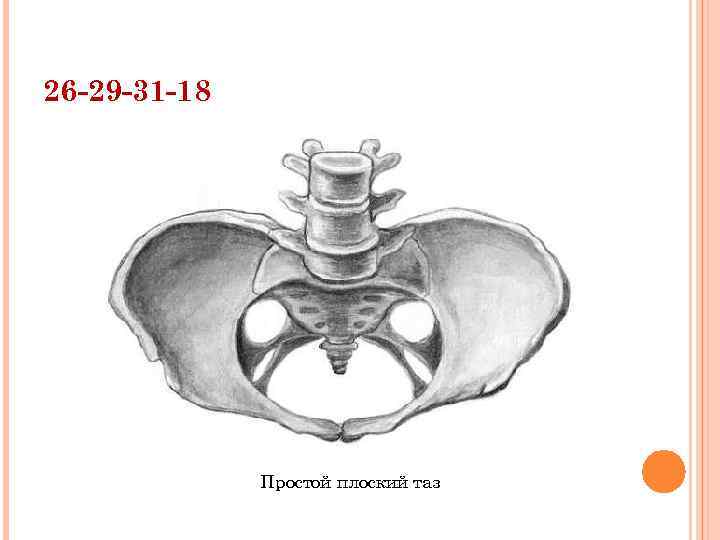 26 -29 -31 -18 Простой плоский таз 