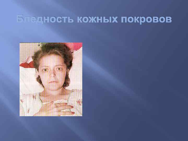 Бледность кожных покровов 