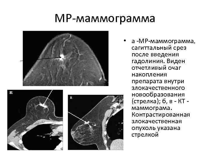 Центр маммограммы