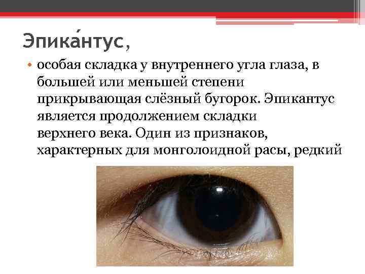 Эпика нтус, • особая складка у внутреннего угла глаза, в большей или меньшей степени