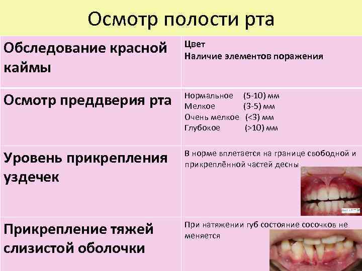 Осмотр полости рта Обследование красной каймы Цвет Наличие элементов поражения Осмотр преддверия рта Нормальное