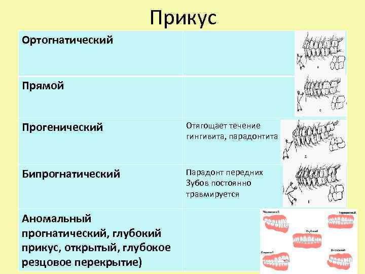 Прикус Ортогнатический Прямой Прогенический Отягощает течение гингивита, парадонтита Бипрогнатический Парадонт передних Зубов постоянно травмируется