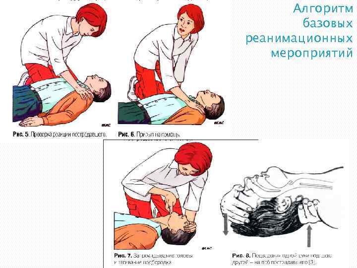 Алгоритм базовых реанимационных мероприятий 