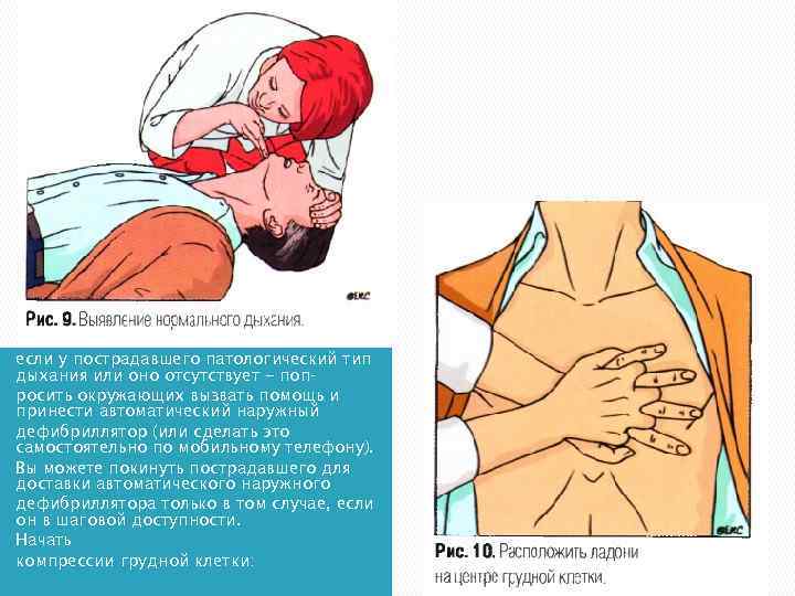 если у пострадавшего патологический тип дыхания или оно отсутствует - поп росить окружающих вызвать