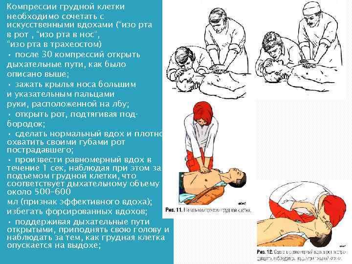 Компрессии грудной клетки необходимо сочетать с искусственными вдохами (“изо рта в poт , “изо