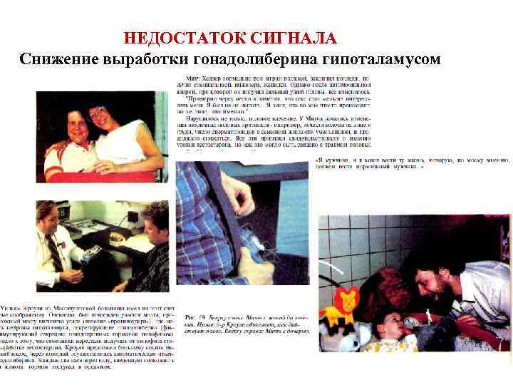 НЕДОСТАТОК СИГНАЛА Снижение выработки гонадолиберина гипоталамусом 