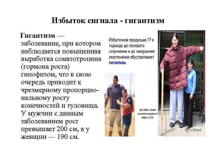 Избыток сигнала - гигантизм Гигантизм — заболевание, при котором наблюдается повышенная выработка соматотропина (гормона