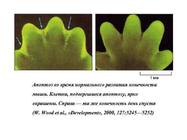 Апоптоз во время нормального развития конечности мыши. Клетки, подвергшиеся апоптозу, ярко окрашены. Справа —