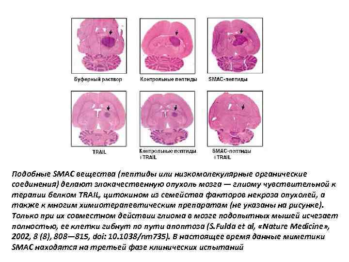 Подобные SMAC вещества (пептиды или низкомолекулярные органические соединения) делают злокачественную опухоль мозга — глиому