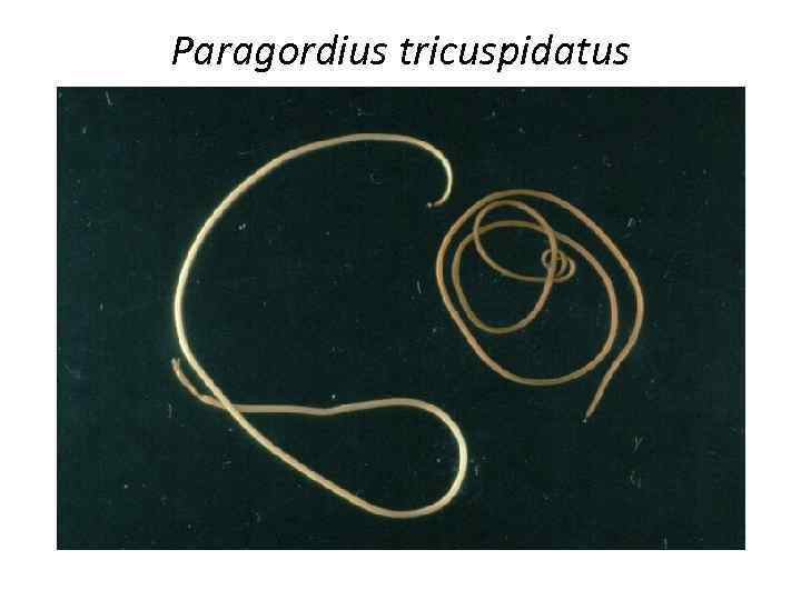 Paragordius tricuspidatus 